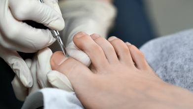 close up of podiatrist treating fungal toenails using tool